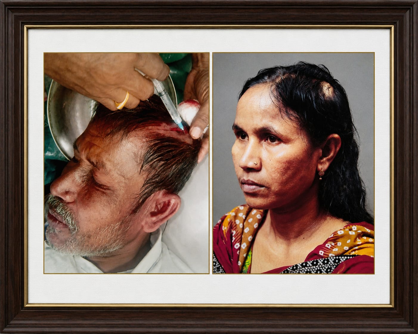 কুড়িগ্রামে জমিজমা নিয়ে সংঘর্ষ : স্বামী-স্ত্রীসহ আহত ৫