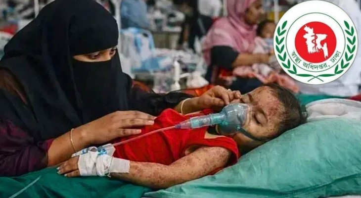 হাম উপসর্গে ৭ জনের মৃত্যু, নতুন রোগী ১১৩৫